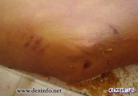 Пуля попала точно в сердце