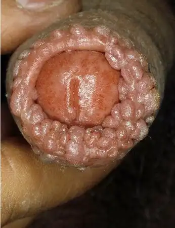 а проблевацо   ???