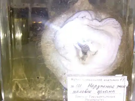 Анатомический... все думаю знаю!