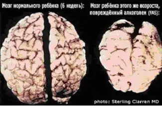 Влияние алкоголя на деторождение Влияние алкоголя на деторождение