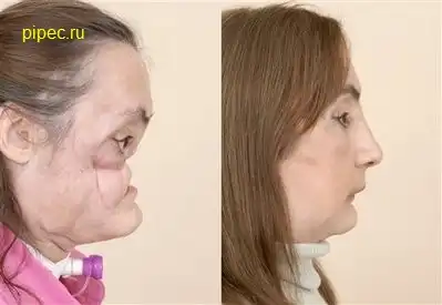 Жесть жестянка 