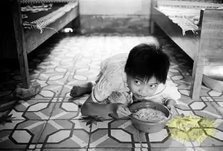 Последствия химической войны во Вьетнаме (31 фото , мега жесть)