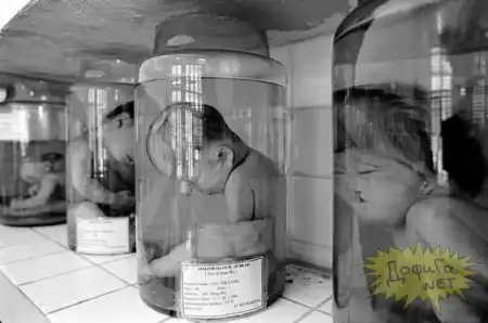 Последствия химической войны во Вьетнаме (31 фото , мега жесть)