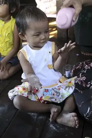 Девочка с 26-ю пальцами из Мьянмы (фото + видео)