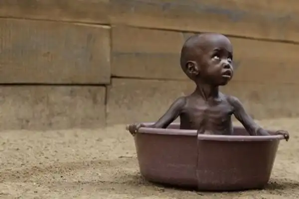 Голод в Сомали.
