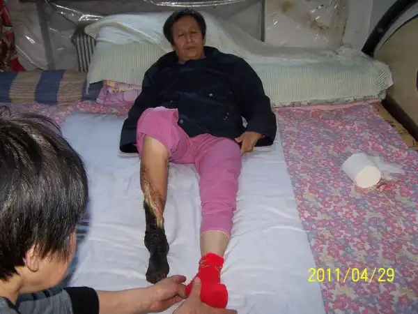 Женщина стала жертвой пыток китайской полиции
