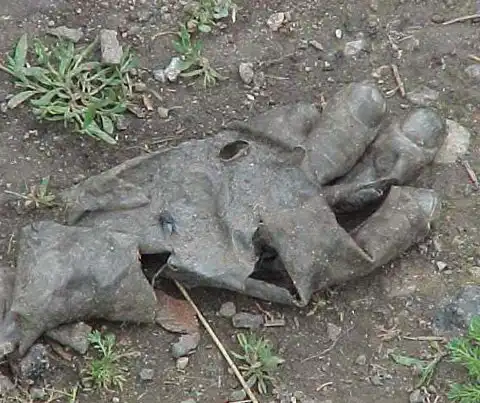 Скальпированная рана руки.