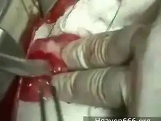 Ленточные черви в сердце.