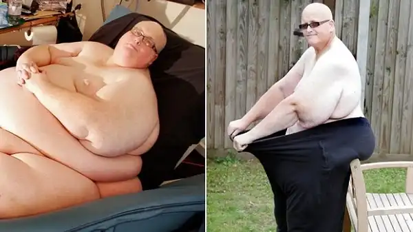Самый толстый мужчина планеты похудел на 292 килограмма