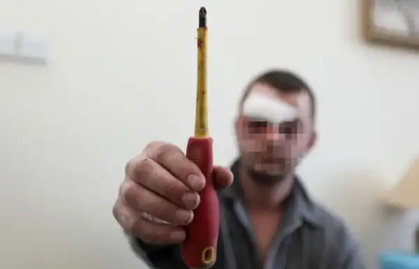 Мужик вогнал себе в мозг отвертку, закурил и отправился в больницу