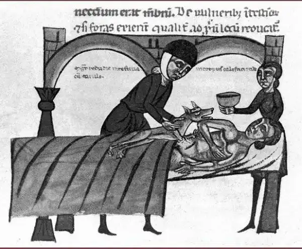 Беспощадная средневековая медицина