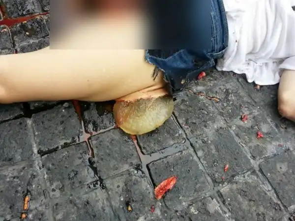 Девушка выпала из окна многоэтажки