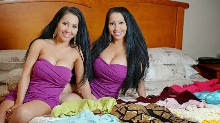 Австралийские близняшки потратили 250 000 долларов, чтобы стать самыми похожими друг на друга людьми