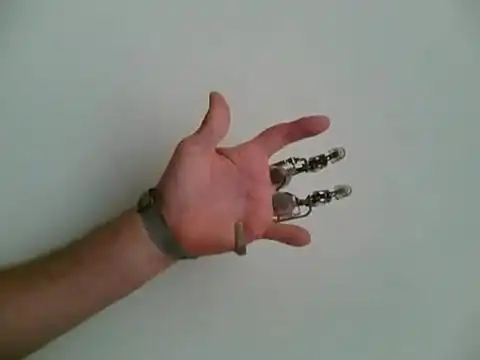 X-Finger - первые искусственные пальцы
