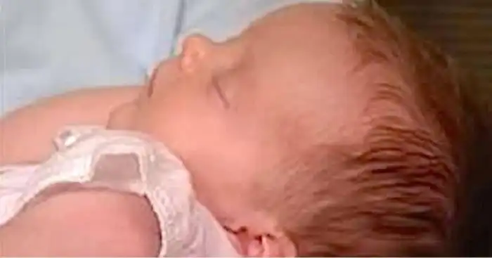 Врачи спасли жизнь еще не родившегося ребенка, избавив его от гигантской опухоли