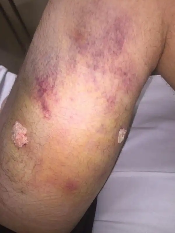 Паренек легкомысленно разрядил пистолет себе в ногу