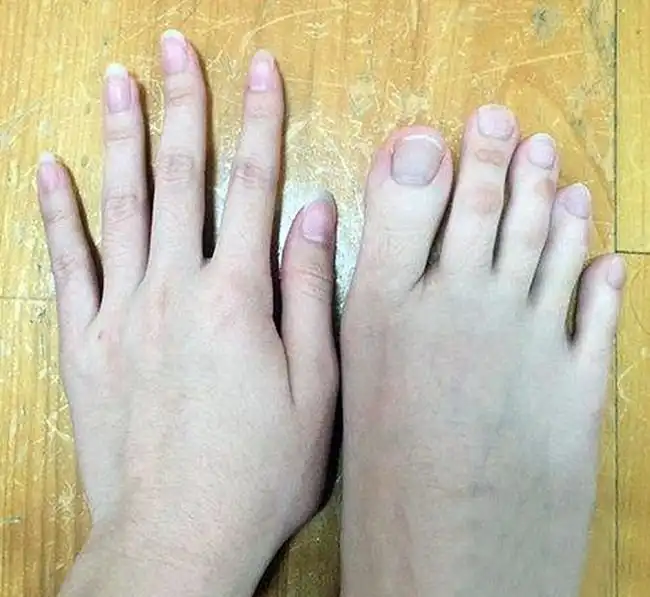 Студентка из Тайваня удивила пользователей сети фотографией своих пальцев ног