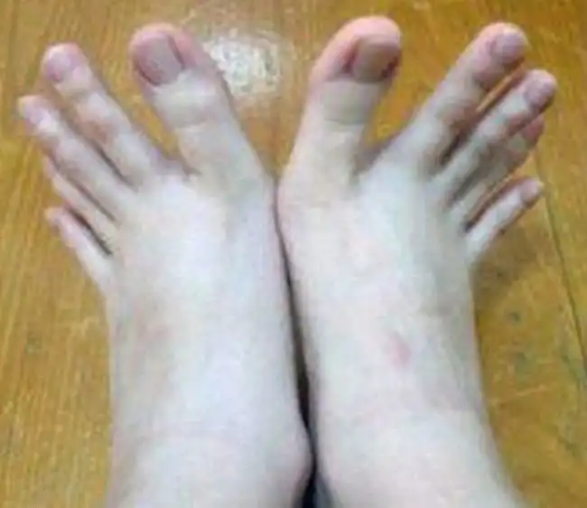 Студентка из Тайваня удивила пользователей сети фотографией своих пальцев ног
