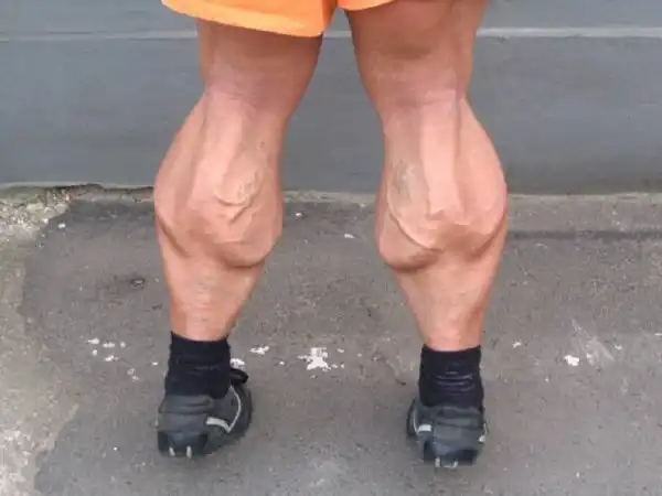 Люди, которые никогда не пропускали день ног