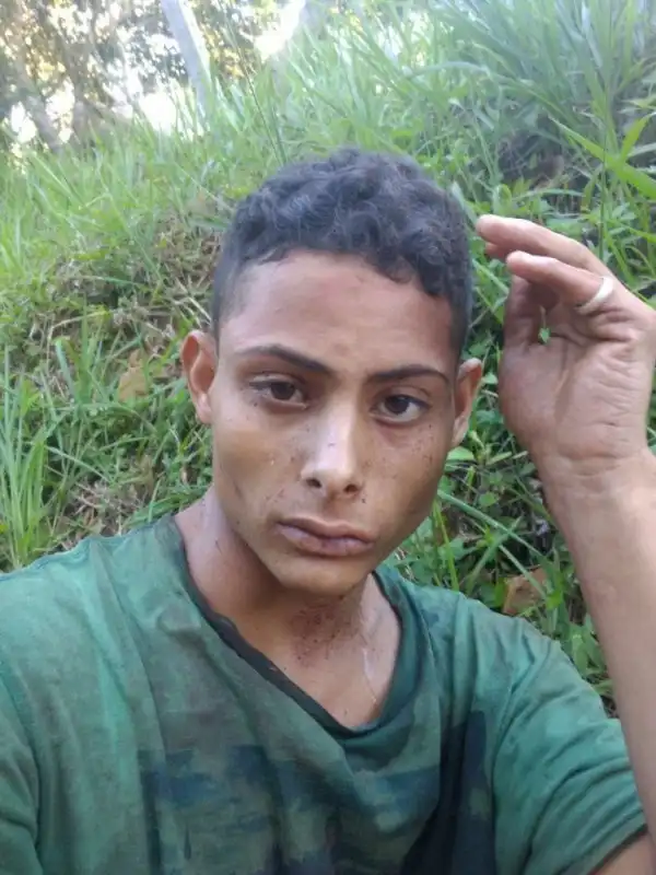 Бразильские копы спасли парня с почти отрезанной головой