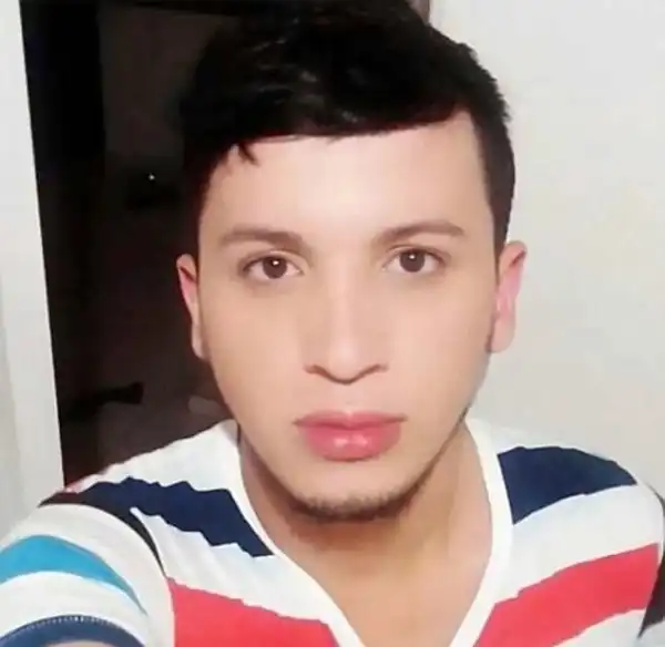 Лицо колумбийского модника после неудачной операции по увеличению щек