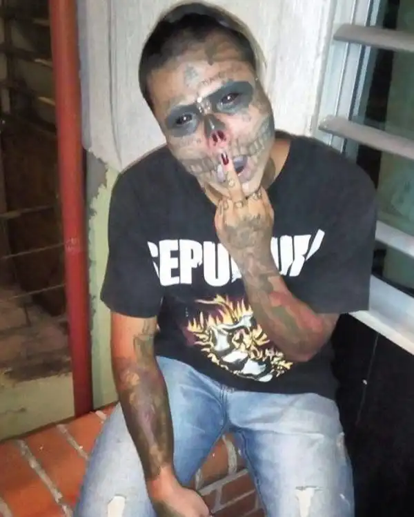 22-летний колумбиец с черепом вместо лица