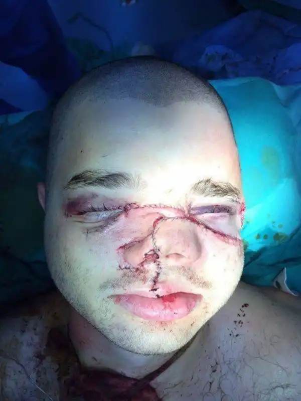 Не был пристегнут в ДТП и что из этого вышло
