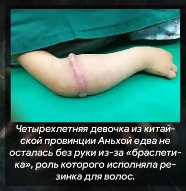 Теперь это твоя фобия