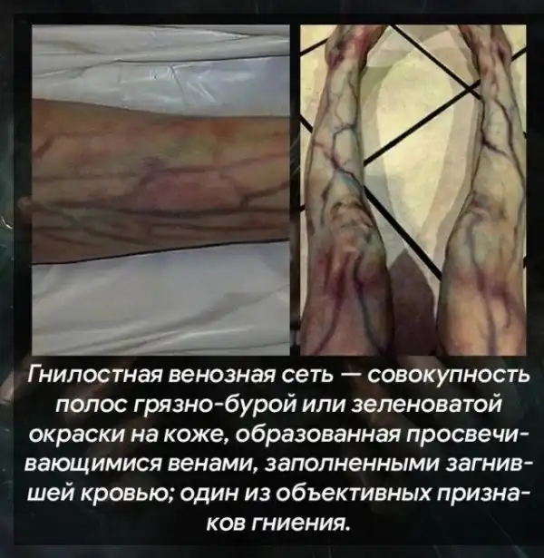 Теперь это твоя фобия