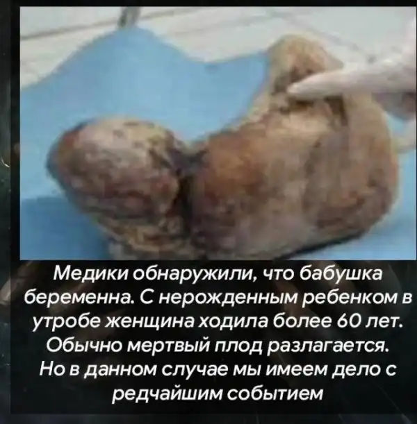 Теперь это твоя фобия