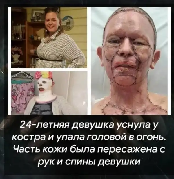 Теперь это твоя фобия