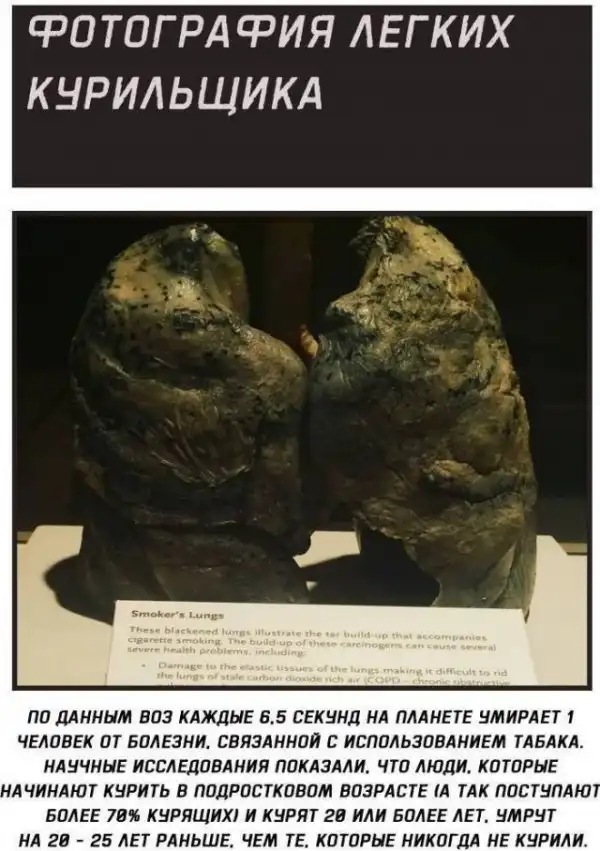 Теперь это твоя фобия