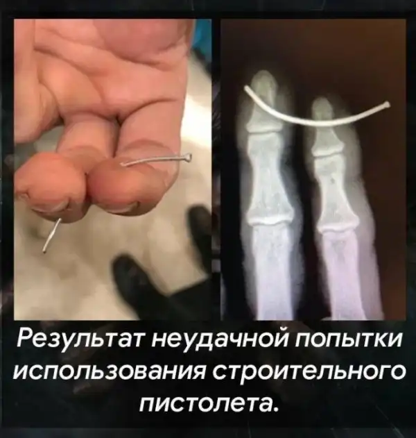 Теперь это твоя фобия