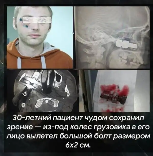 Теперь это твоя фобия