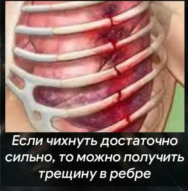 Теперь это твоя фобия