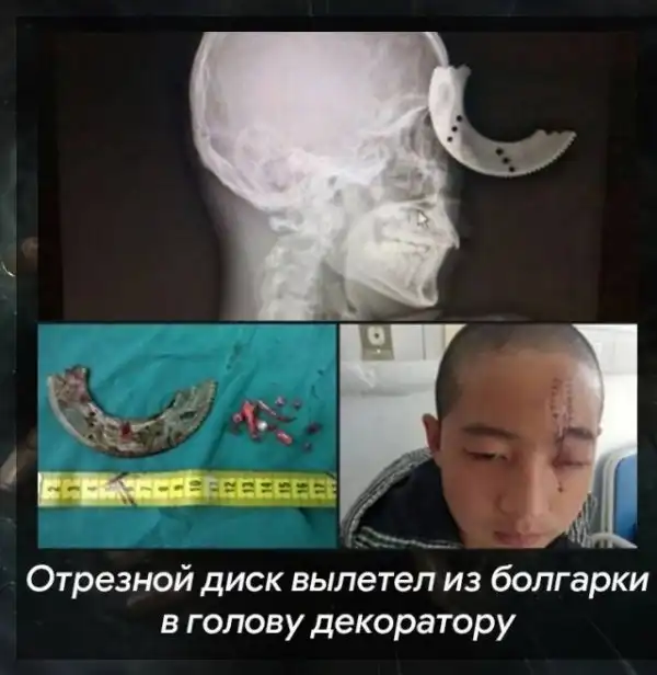 Теперь это твоя фобия