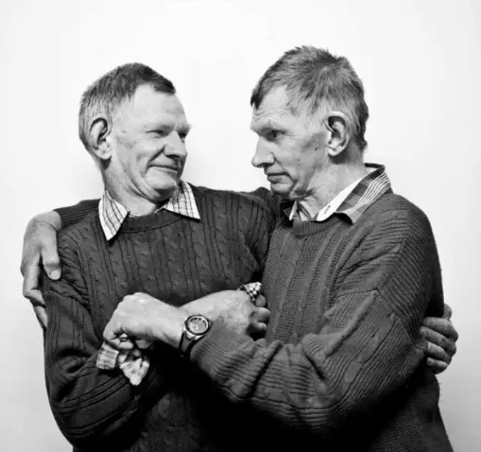 История необычных братьев близнецов: что с ними стало и как они прожили свою жизнь