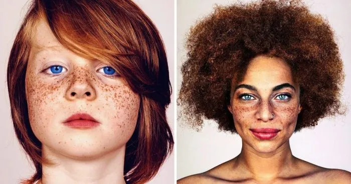Фотограф делает портреты людей с веснушками, доказывая, что эта особенность — изюминка, а не недостаток Фотограф делает портреты людей с веснушками, доказывая, что эта особенность — изюминка, а не недостаток