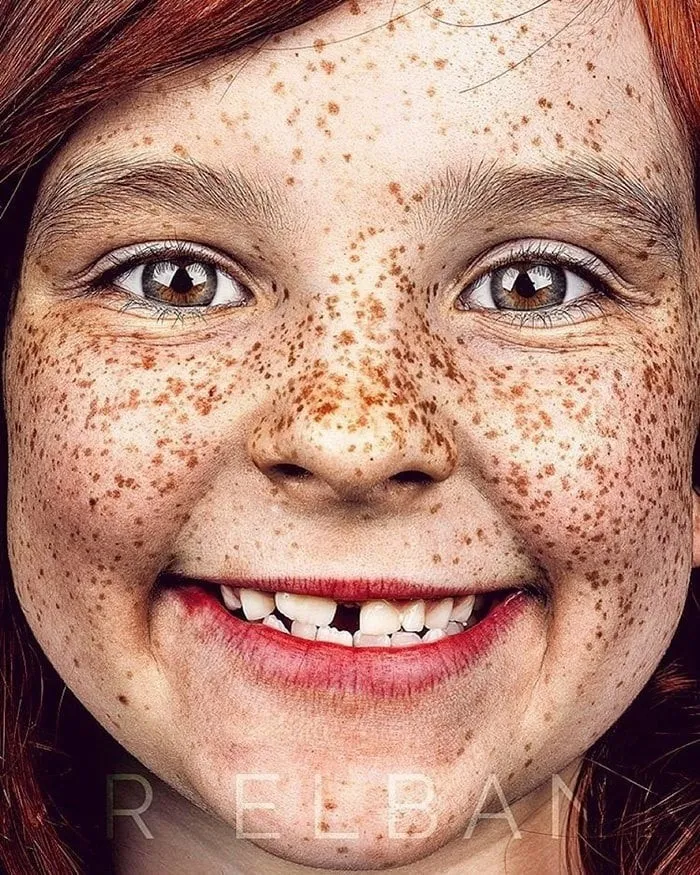 Фотограф делает портреты людей с веснушками, доказывая, что эта особенность — изюминка, а не недостаток Фотограф делает портреты людей с веснушками, доказывая, что эта особенность — изюминка, а не недостаток