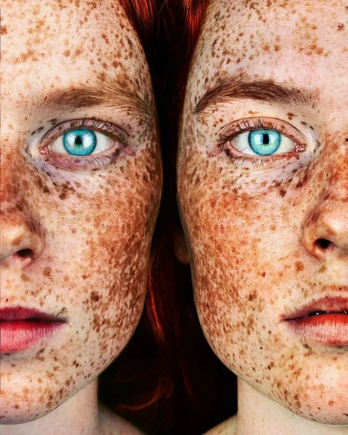 Фотограф делает портреты людей с веснушками, доказывая, что эта особенность — изюминка, а не недостаток Фотограф делает портреты людей с веснушками, доказывая, что эта особенность — изюминка, а не недостаток