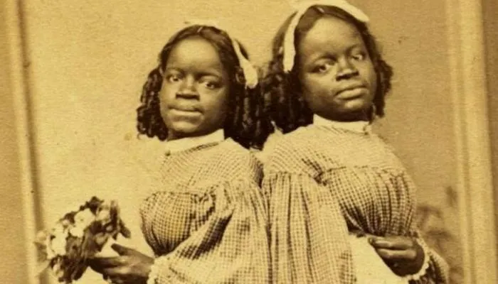 Как две чернокожие сросшиеся рабыни смогли прожить удивительную жизнь