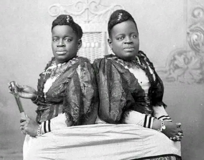 Как две чернокожие сросшиеся рабыни смогли прожить удивительную жизнь