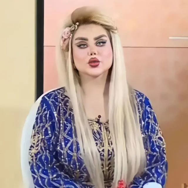 Далия Наим сделала больше 40 пластический операций, чтобы превратиться в Барби