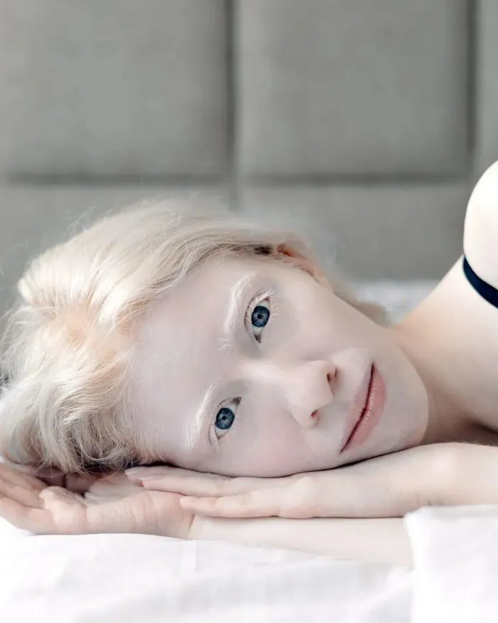 14 человек с альбинизмом, похожих на инопланетян