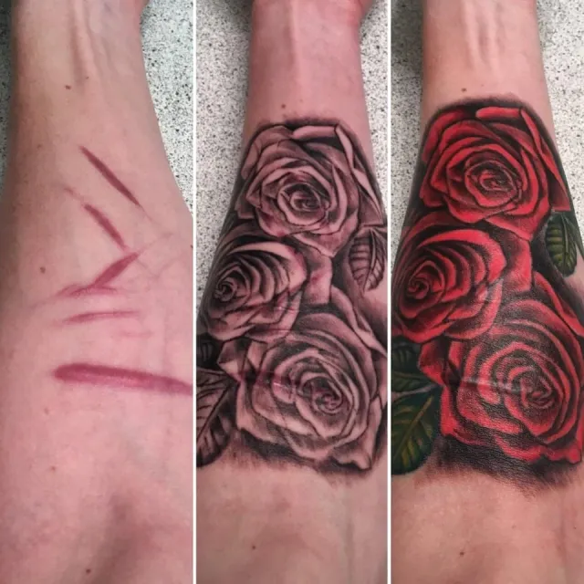 Как люди оригинально обыграли свои шрамы с помощью татуировок