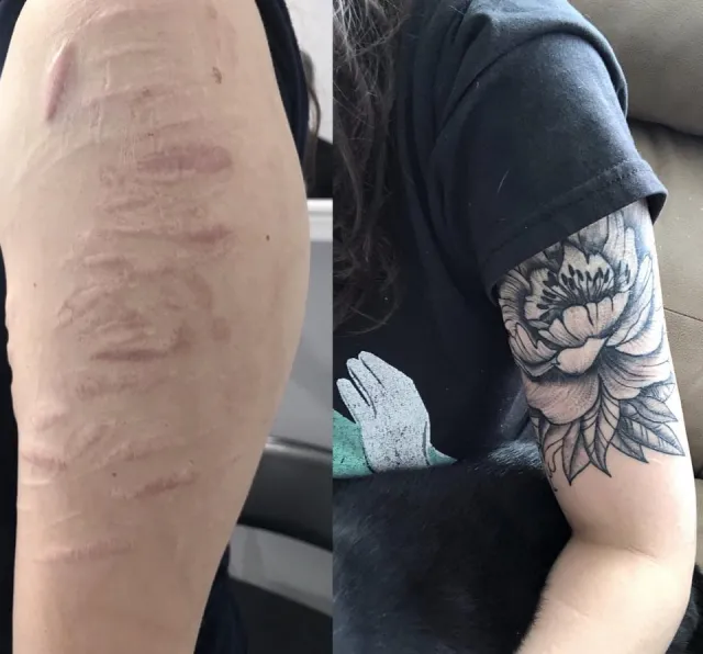 Как люди оригинально обыграли свои шрамы с помощью татуировок